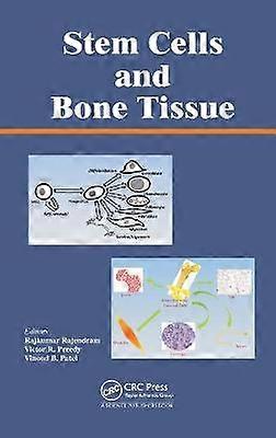 Stem Cells and Bone Tissue