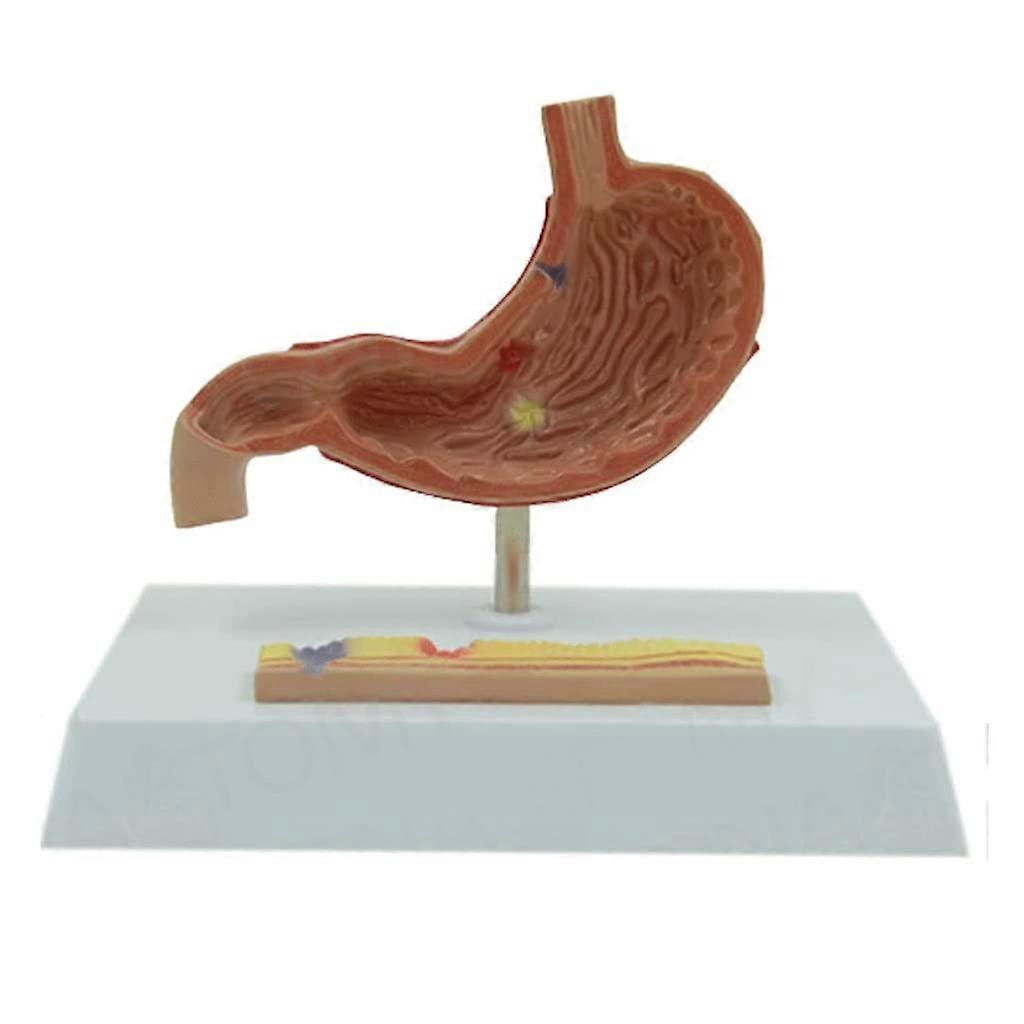 Human Stomach Anatomy Model with Base for Medical Teaching and Display