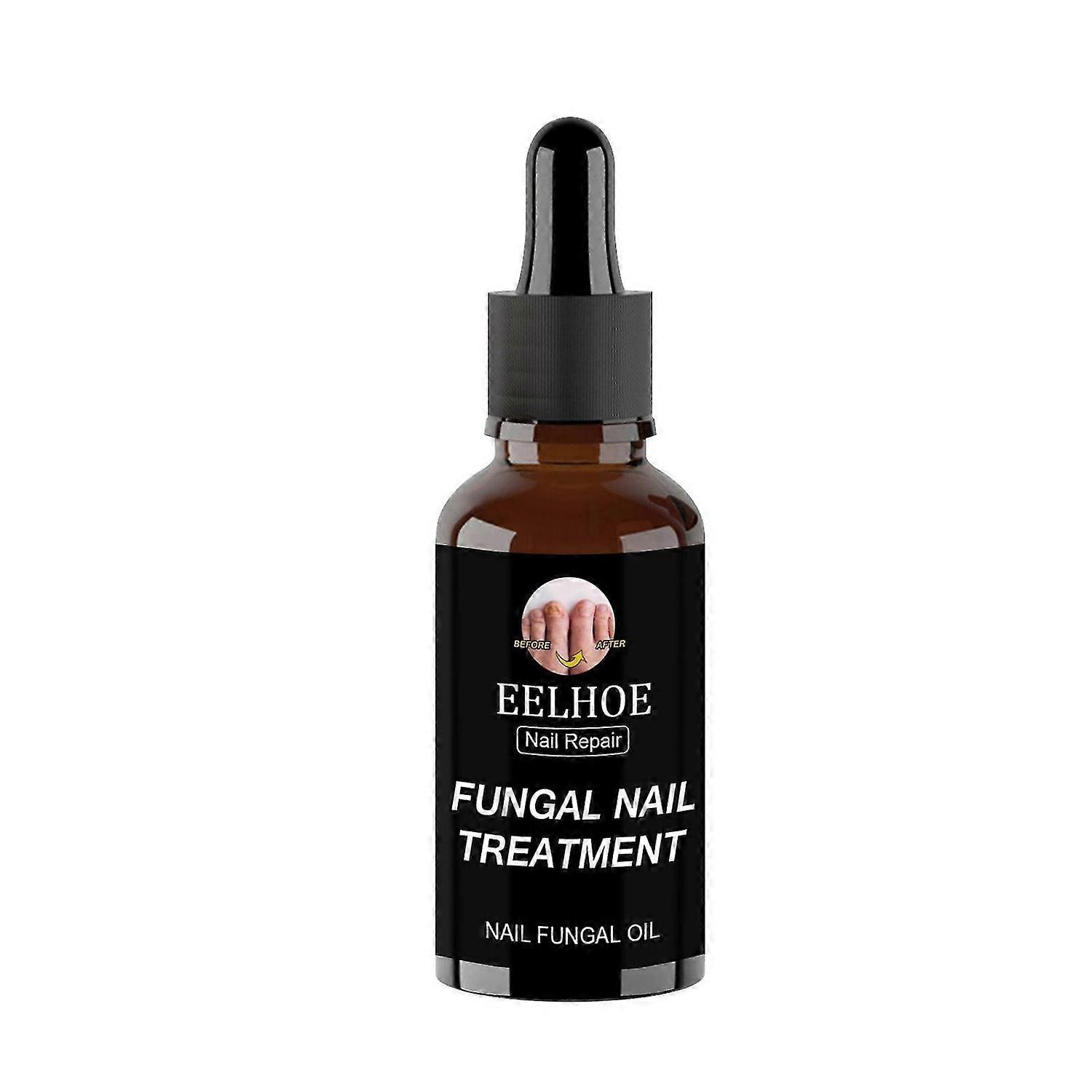 30ml/50ml Powerful Nails Care Repair Nail Anti-Fungus Onychomycosis Removal