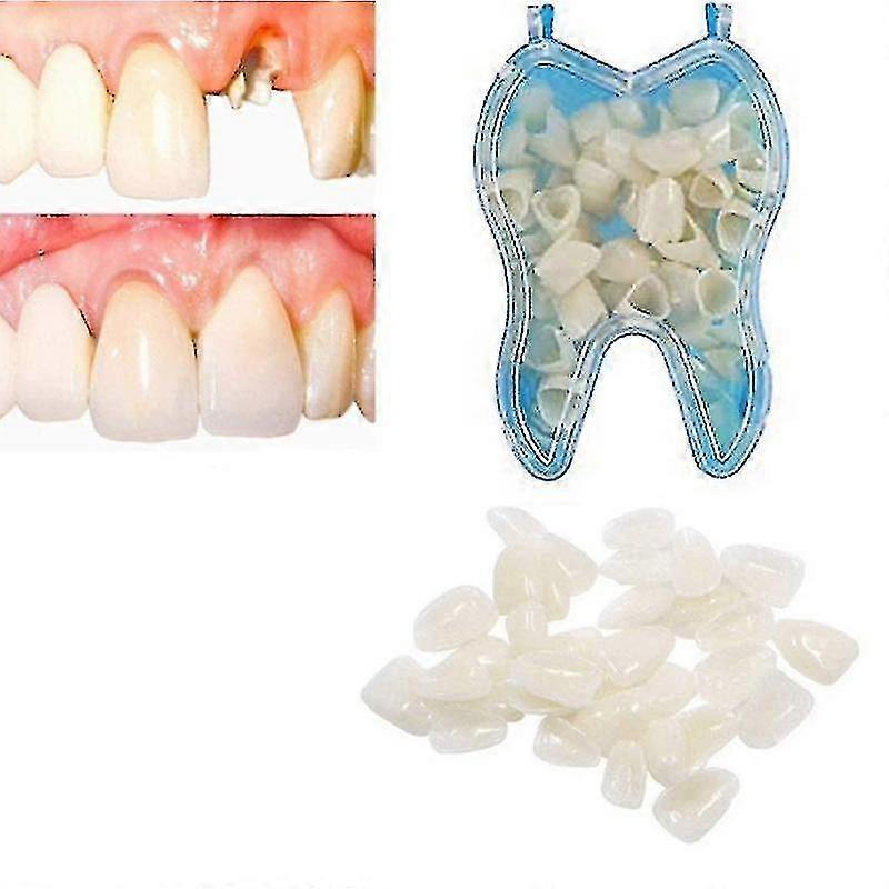 Temporary Denture Braces Occlude Upper Dentures Veneer Dentures Missing Teeth Broken Teeth - Aespa