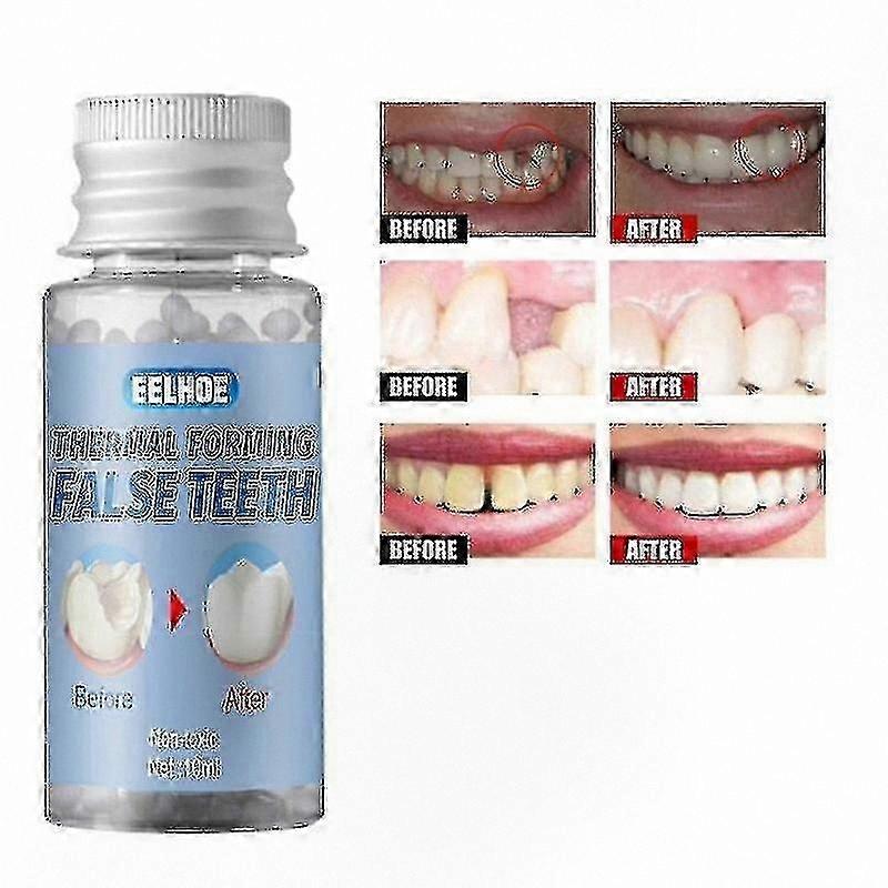 Custom Fit Denture Adhesive for Secure Hold and Gap Repair, Natural Resin Solution for Loose Teeth