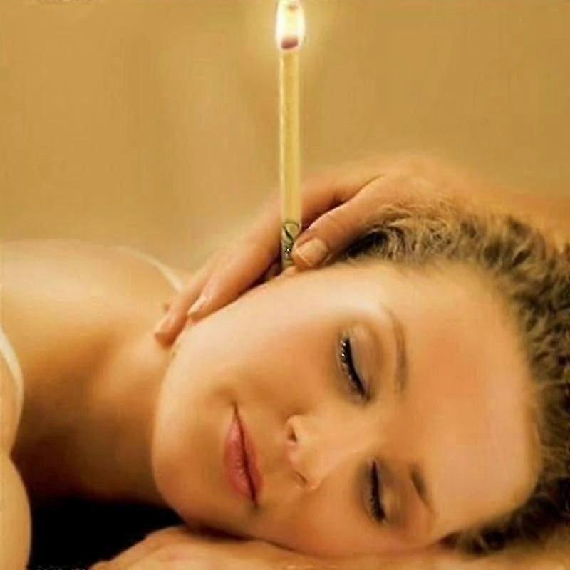 20 db fülgyertya kúpos méhviasz természetes fülápoló fülzsír removar