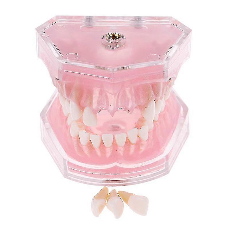 Dental Orthodontic Typodont Plastic Standard Model 4004 With 28 Removeable Teeth