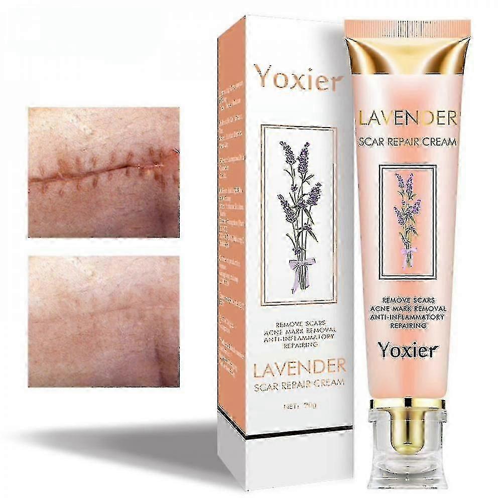 20gラベンダーの傷跡の修理クリーム女性男性のための効果的なにきびの傷跡除去ジェル