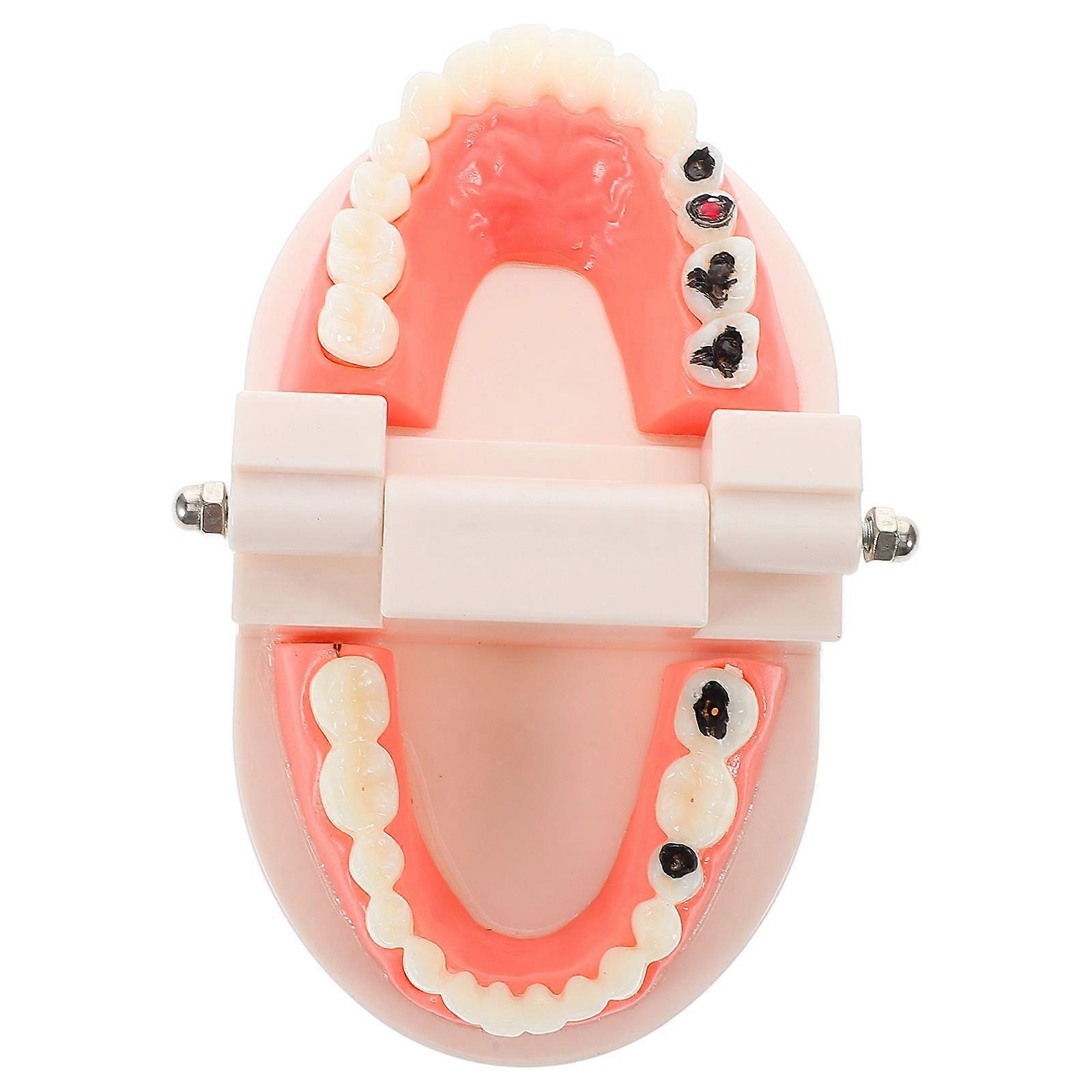 Removable Dentist Model Teeth for Education Teaching Durable Material