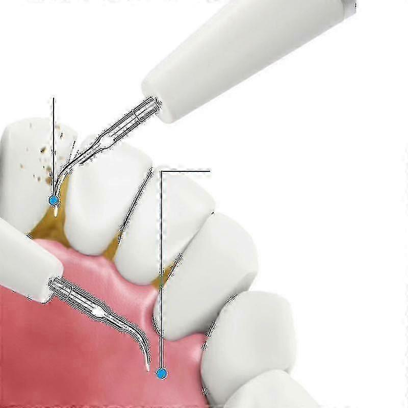 Ultrasonic Electric Calculus Remover Tartar Scaler Scraper Tooth Cleaner_L03