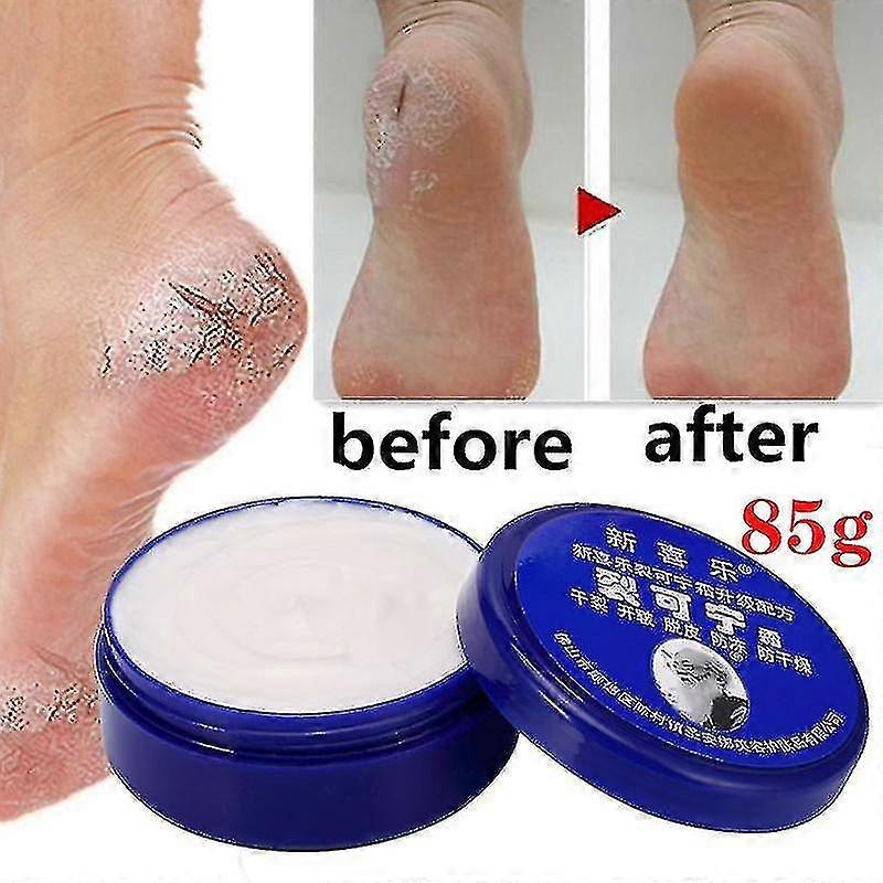 85g繁体字中国語オイル乾燥防止亀裂フットクリームかかとひび割れた修理クリーム除去古い角質手の足のケア家族のためのTw