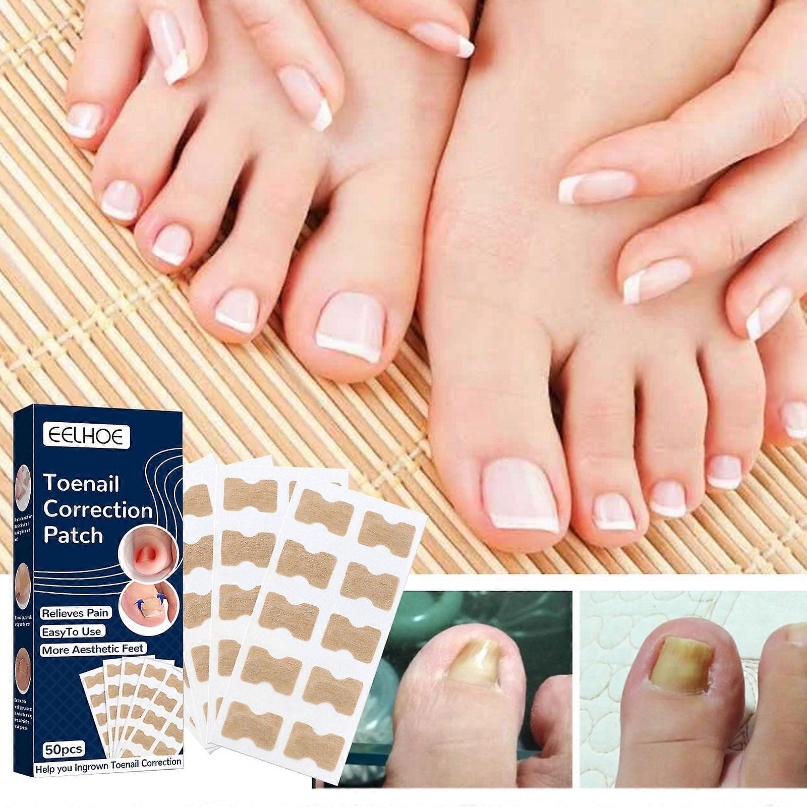 EELHOE Nail Correction Patch, Nail Insert Correction And Repair Toe Manicure Nail Patch