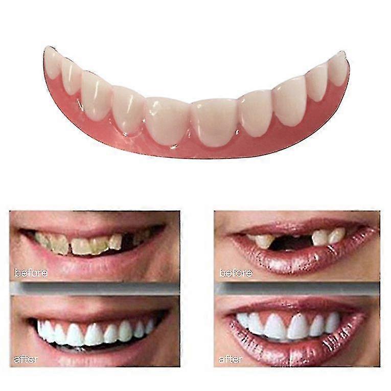 EVAGO Perfect Instant Smile Comfort Fit Flex Teeth Whitening Denture Paste Cover