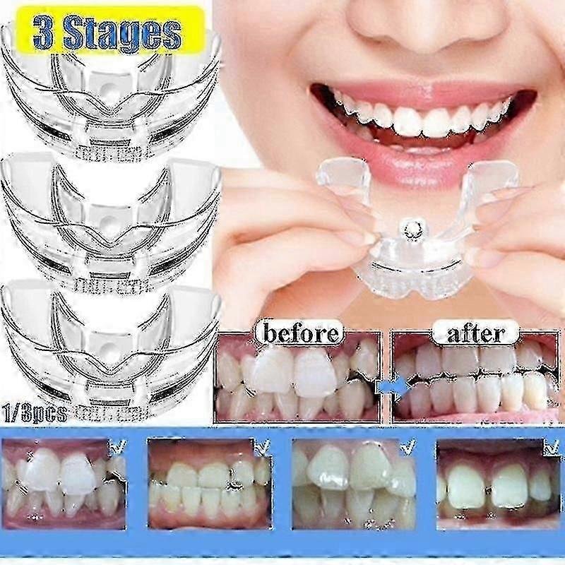 成人の歯の矯正のための歯科矯正用シリコンリテーナー