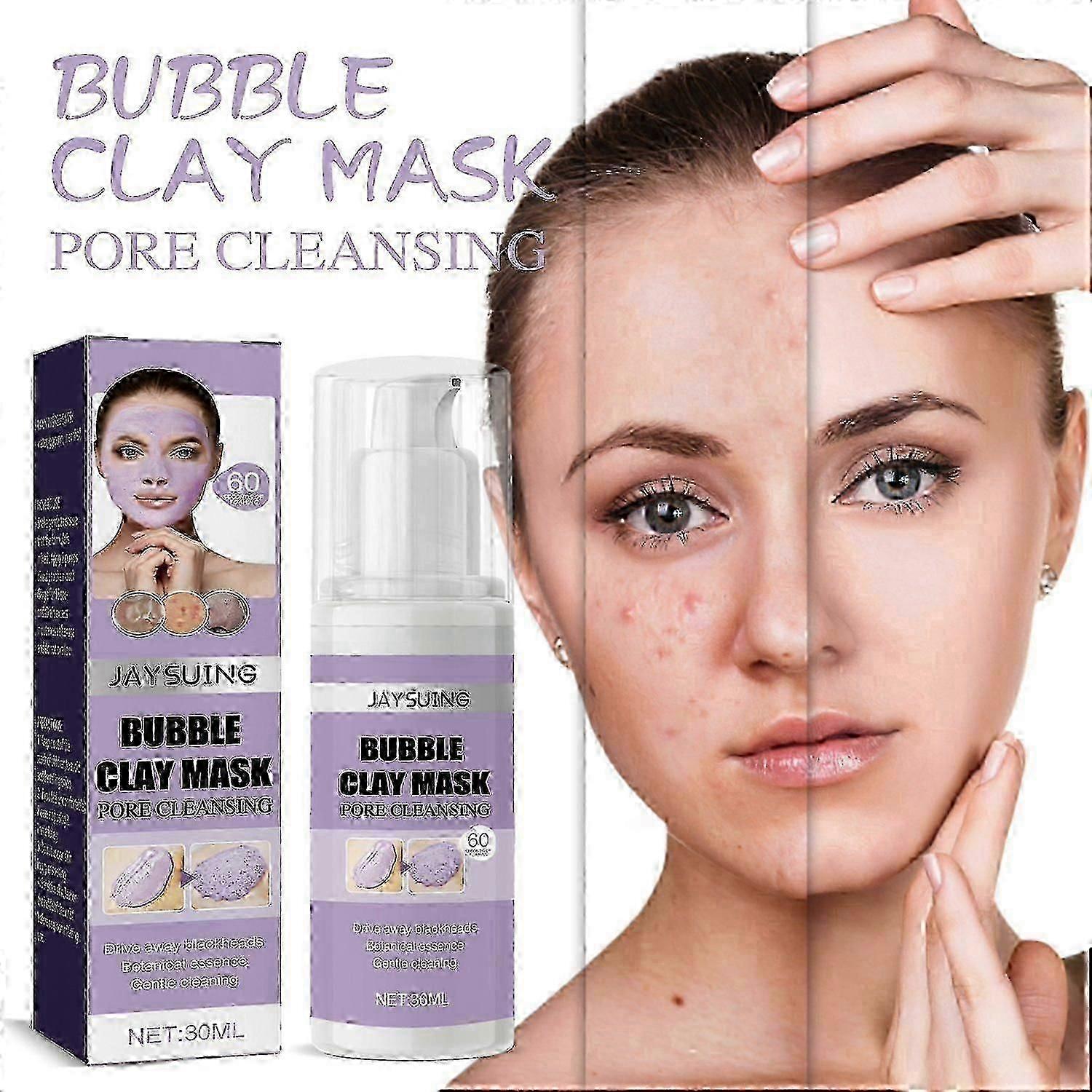 Jaysuing Bubble Clay Mask, Remove Facial Blackheads, Pimples And Acne Clean Applicator Mask