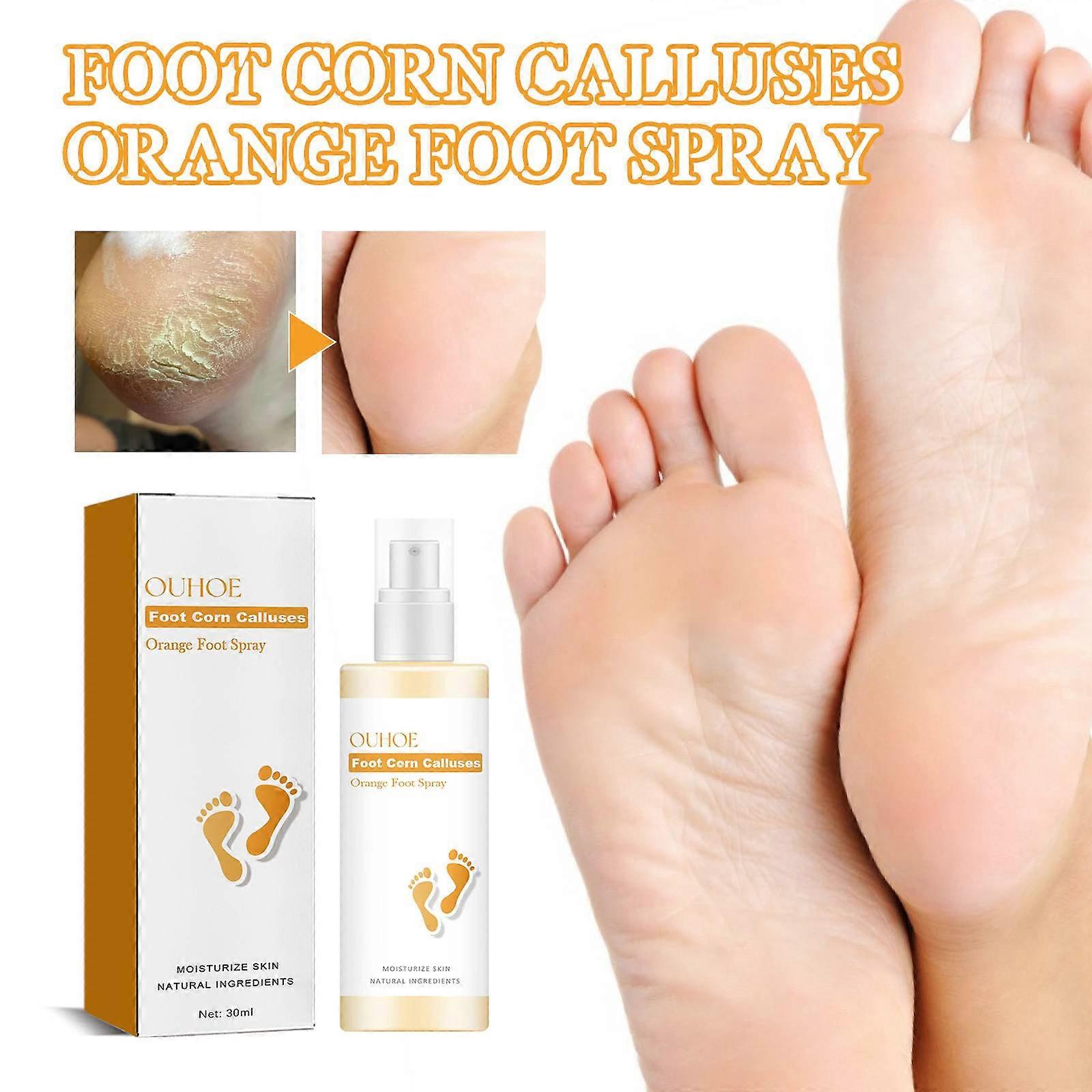 Foot Corn Calluses Orange Foot Spray 30ml