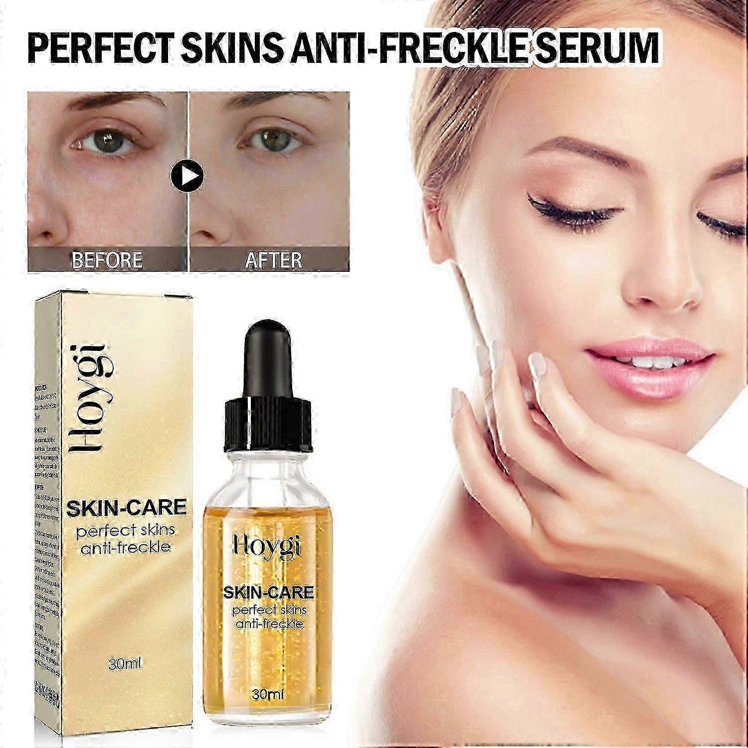 Hoygi Perfect Skins סרום נגד נמשים, מבהיר, מחדש, מעניק לחות ואנטי קמטים