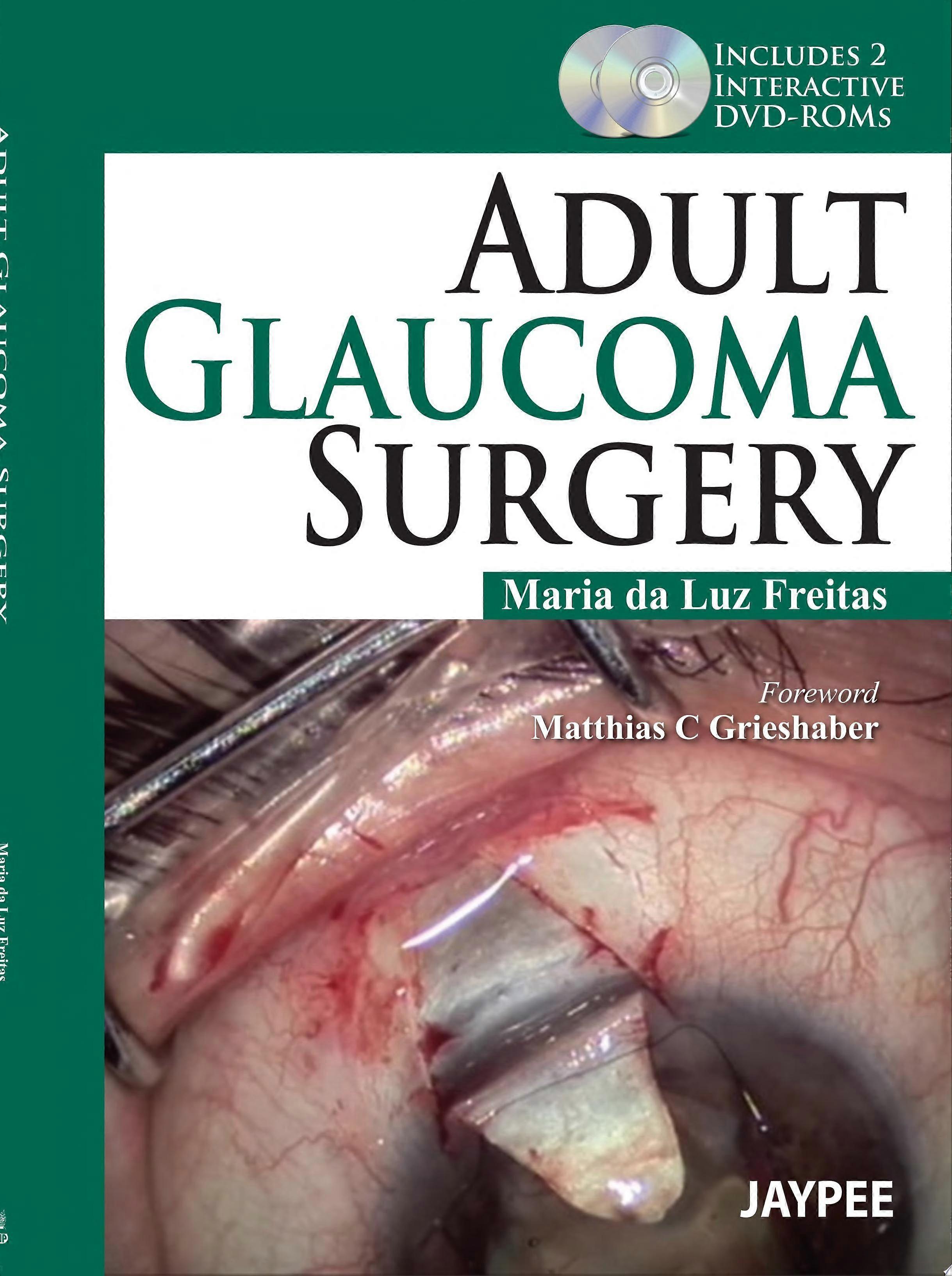 Adult glaucoma surgery