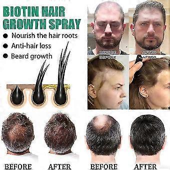 Biotin Haarwachstumsspray Anti-Haarausfall Schnelles Nachwachsen Kopfhautbehandlungsserum
