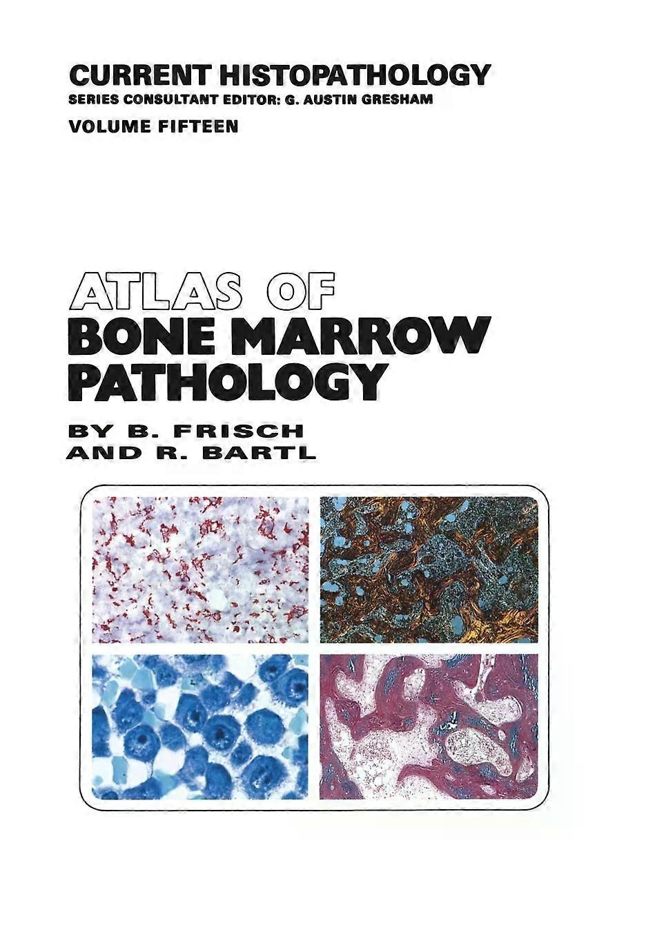 Atlas Of Bone Marrow Pathology by Reiner Bartl Paperback