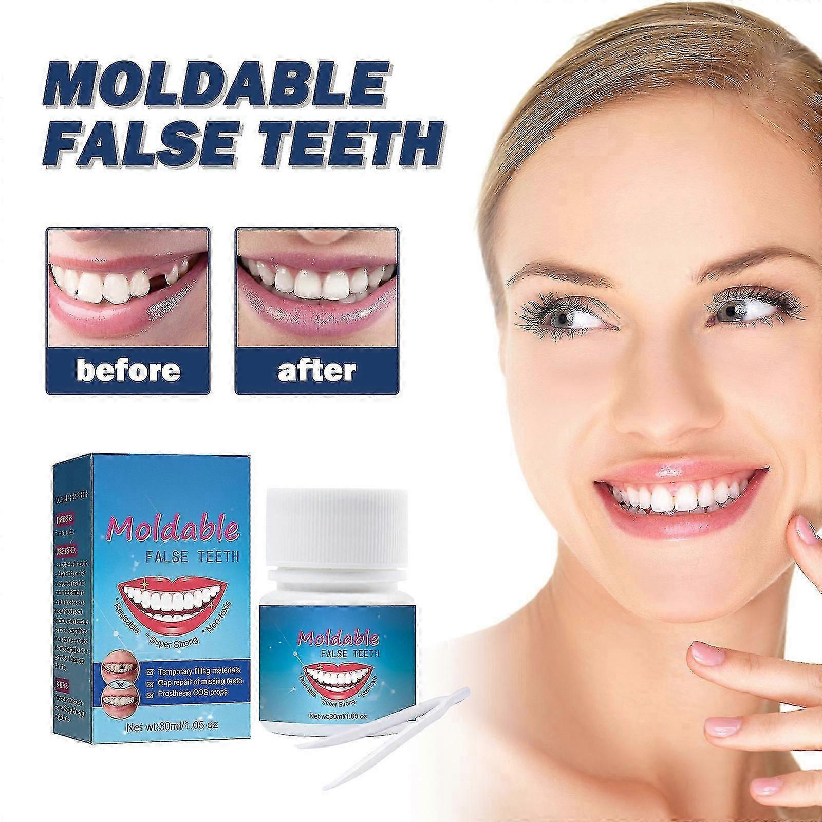 Tooth Repair Kit Missing Tooth Replacement Kit Missing Chipped And Broken Tooth Gaps Temporary Replacement Kit Tw