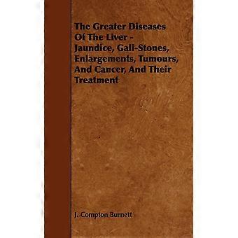 The Greater Diseases Of The Liver - Jaundice Gall-stones Enlargements T - J. Compton Burnett - Paperback - English Book - History