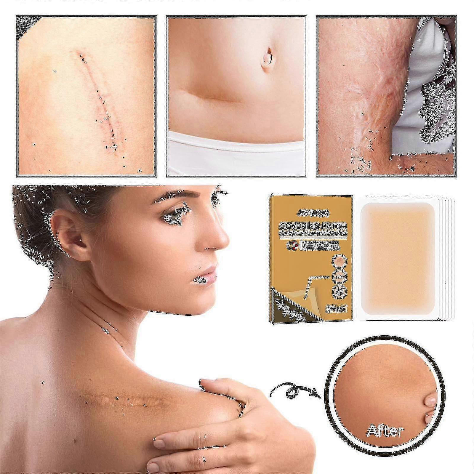 Jaysuing Corrector Invisible (6 piezas) |