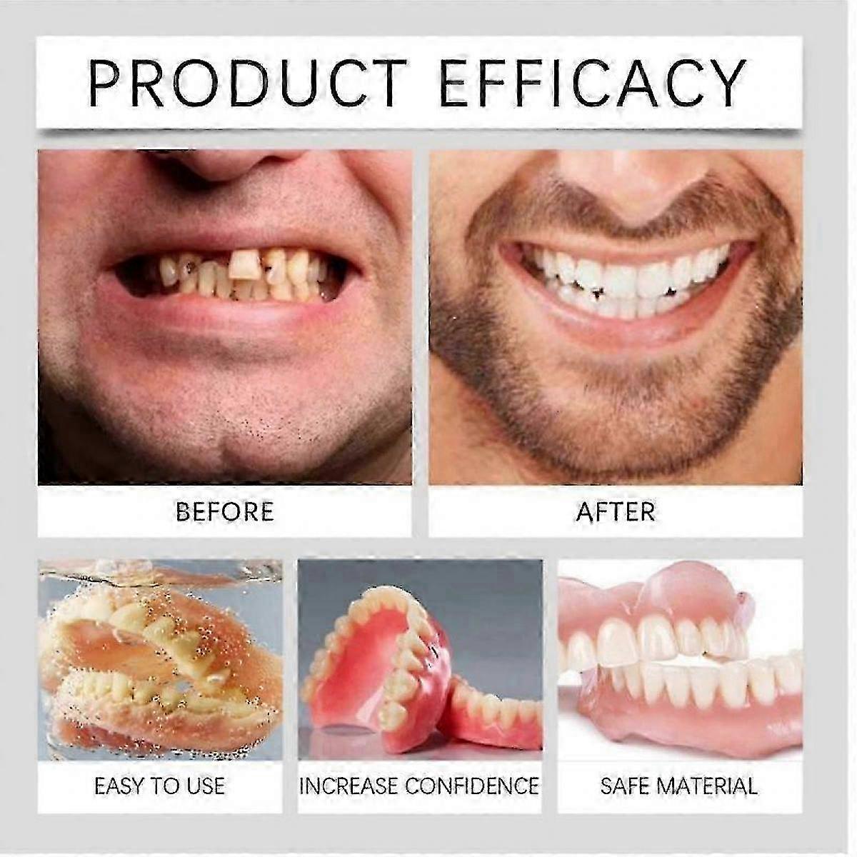 All-Day Wear Full Denture Set