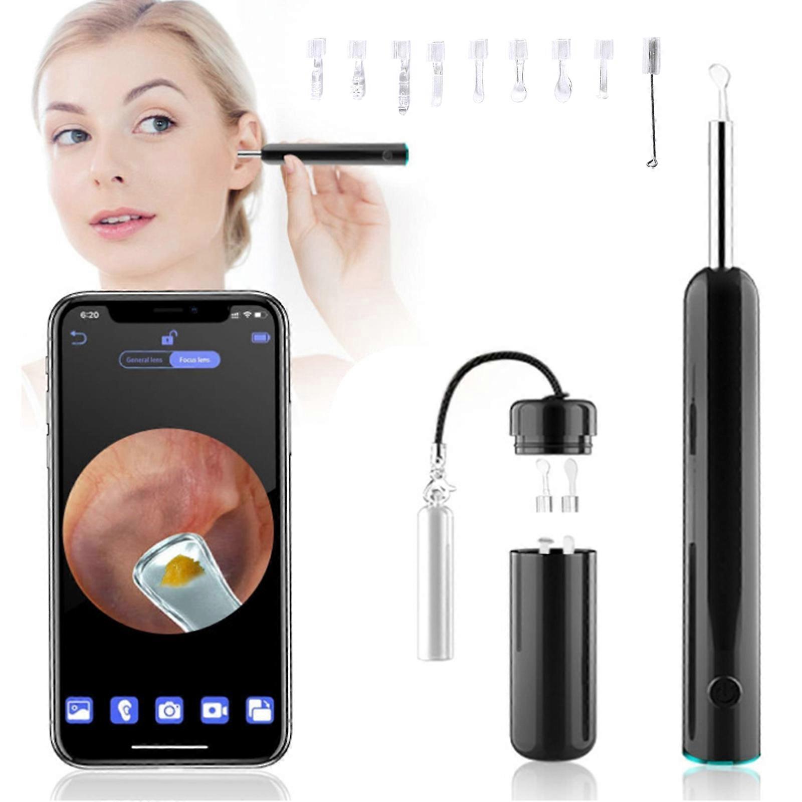 Intelligent Wireless Ear Sampler with High-definition Camera and Visible Ear Spoon Tool