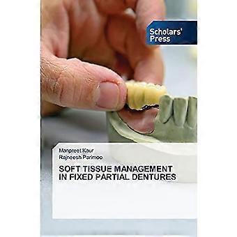 Soft tissue management in fixed partial dentures