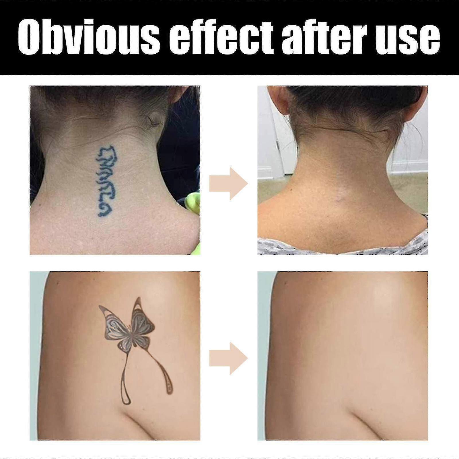 Correttore per tatuaggi