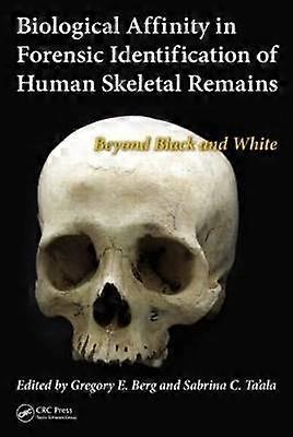 Biological Affinity in Forensic Identification of Human Skeletal Remains