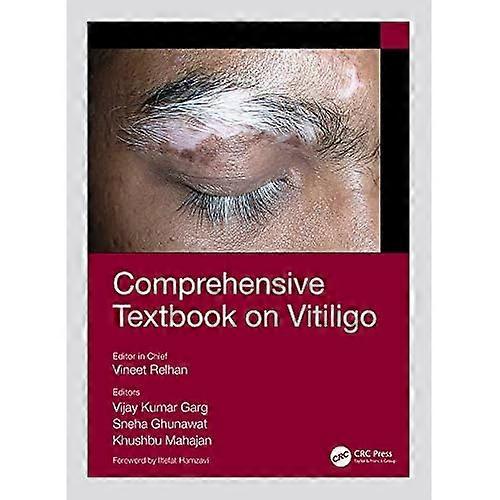 Comprehensive Textbook on Vitiligo