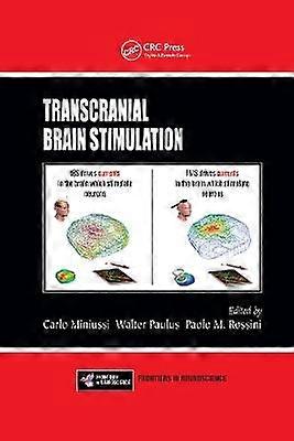 Transkranielle Hirnstimulation