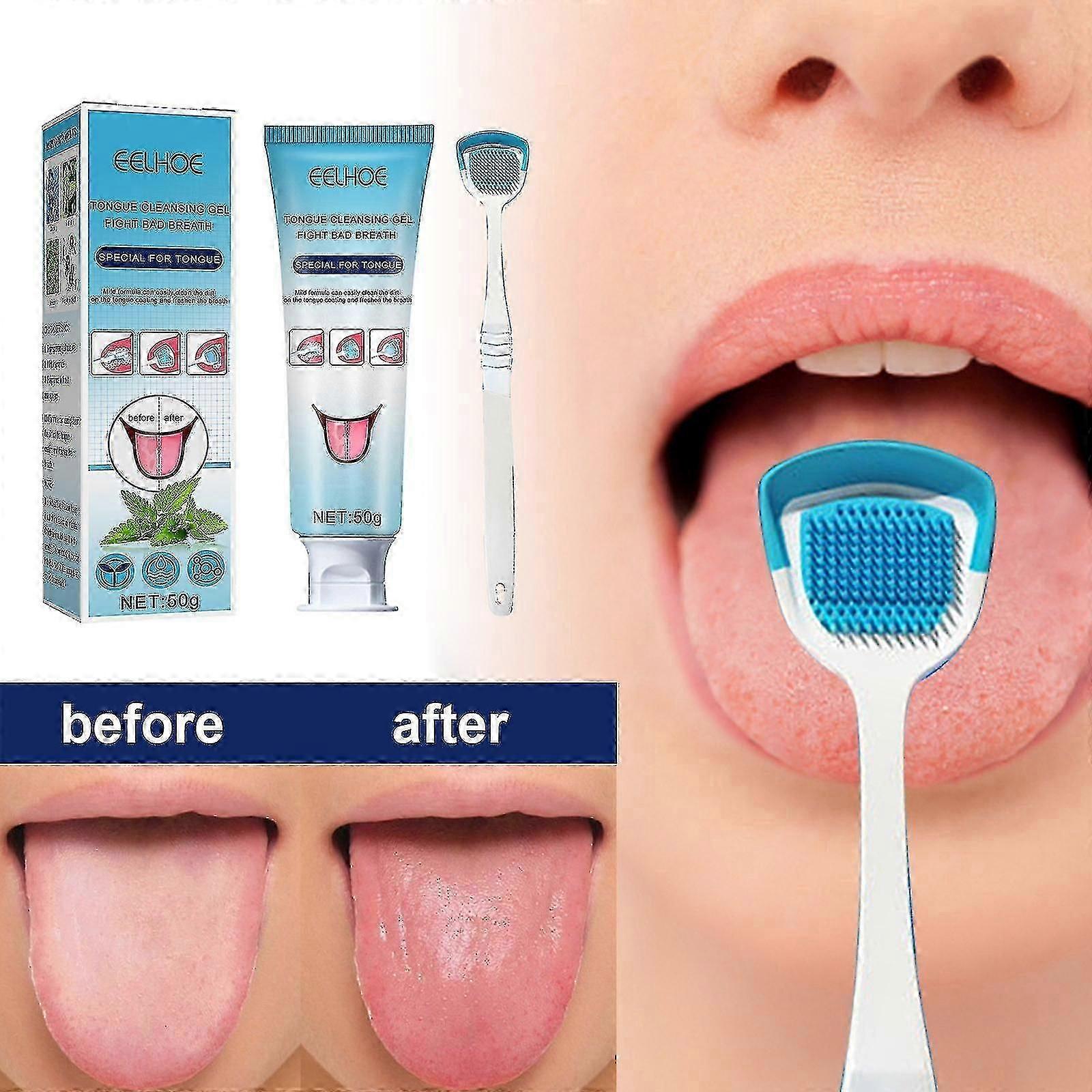 Enlève la mauvaise haleine, nettoie la fourrure de la langue, change le grattoir de langue malodorant, le dentifrice de soins bucco-dentaires