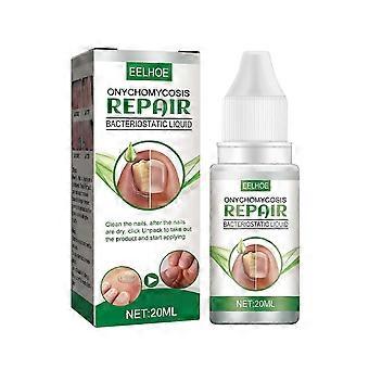 Ätherisches Öl Nagelpilz Reparatur Flüssigkeit Nagelverdickung Verfärbung von weichen Nagelverdickung Typ Onychomyc20ml