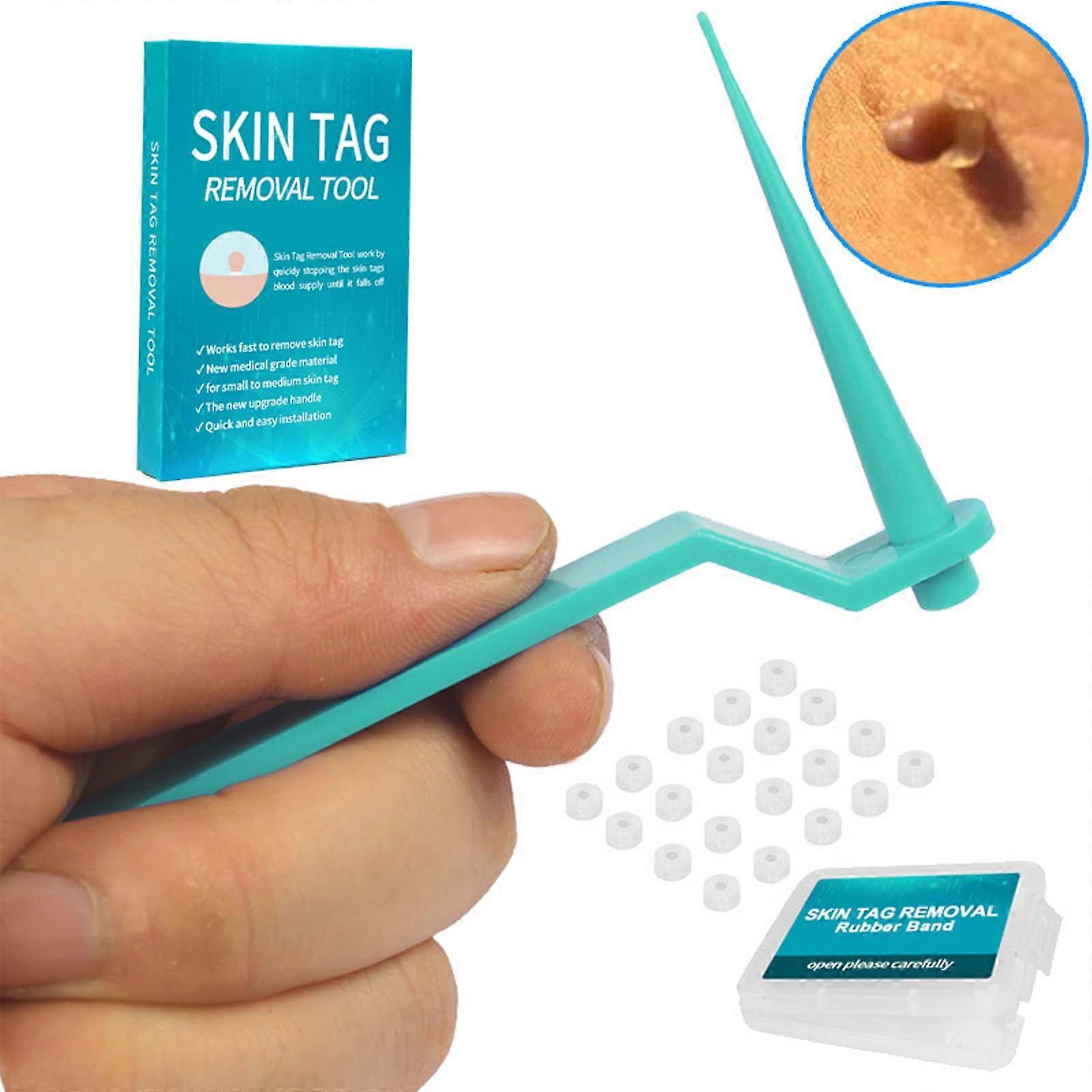 Mole And Tag Removal Tool Contains 20 Meat Monkey Shrink Rubber Rings