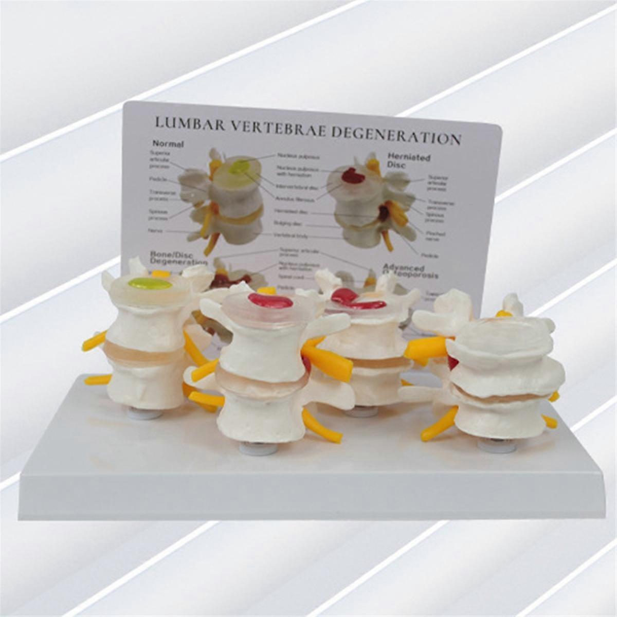 Čtyřstupňový model obratlů, Anatomie a fyziologie člověka Edukační model páteře, Ordinace lékaře