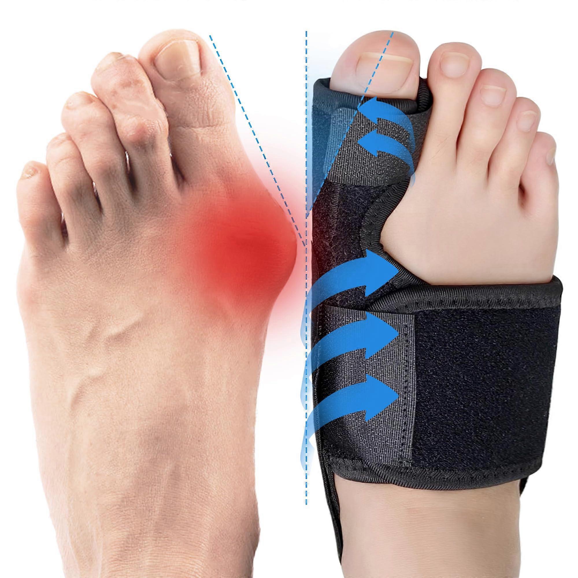 Bunion Corrector For Hallux Valgus And Bunions, 2-Pack, Day And Night Big Toe Pain Relief, Men And Women