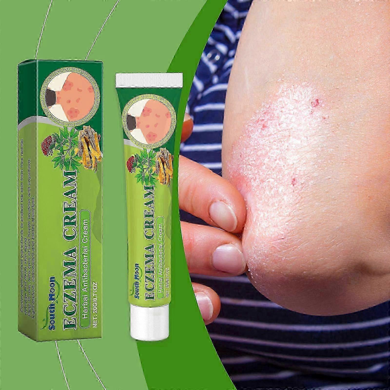 20 g ekseemavoidetta, psoriaasivoidetta, tulehdusta ehkäisevää ja bakteereja tappavaa voidetta, vaurioitunutta ihon suojakerrosta