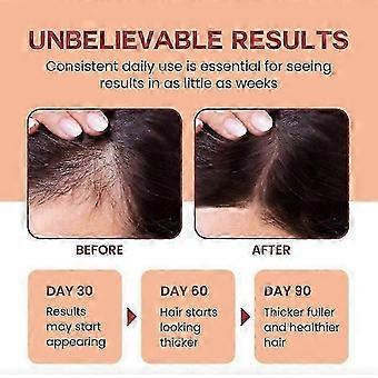 1-3x 120ML Raw Batana Oil for Hair Growth - 100% Pure, Organic Batana Oil for Thicker and Stronger Hair, Unrefined Batana Oil Prevent Hair L
