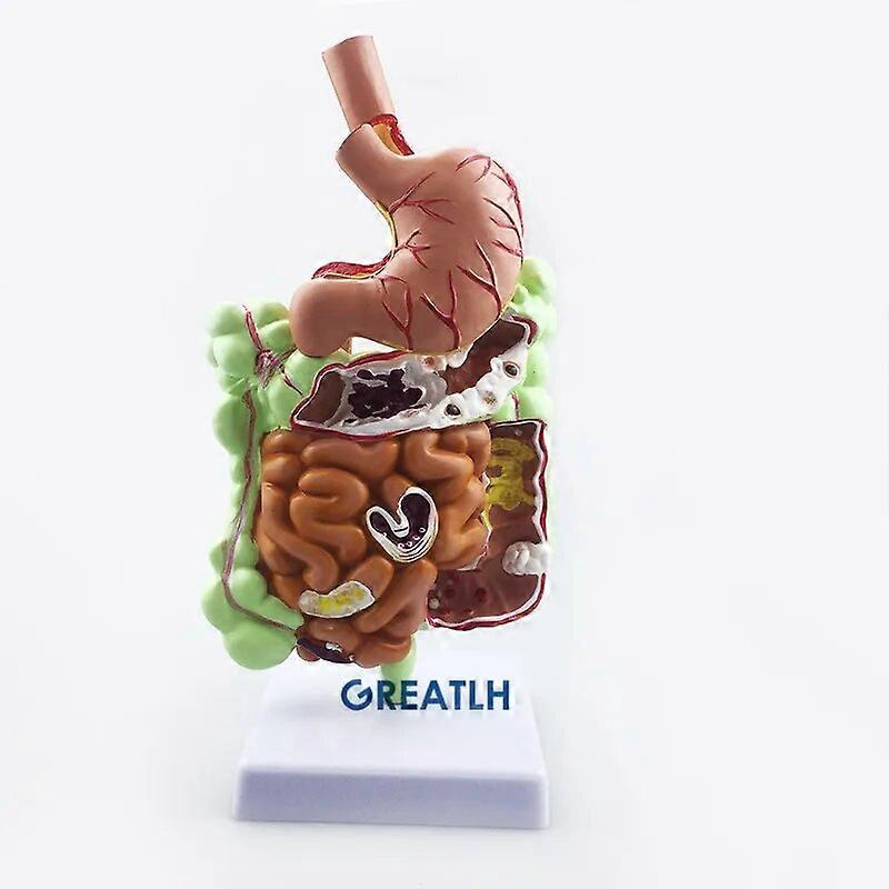 Stomach Cecum Rectal Anatomy Model Human Intestinal System Teaching Model