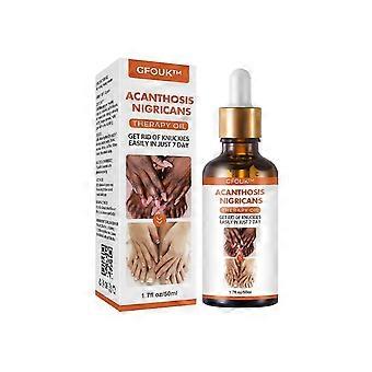 Acanthosis Nigricans Therapie ÖlPermanent 50g