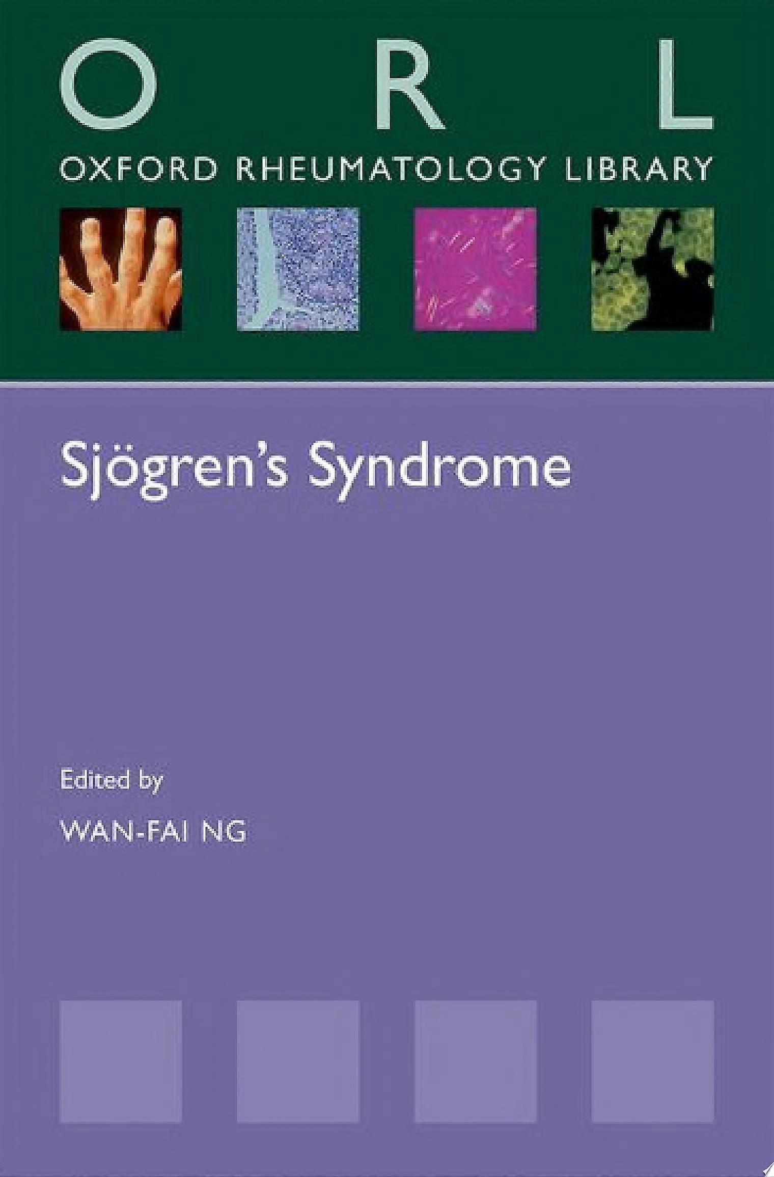 Sjogren's syndrome
