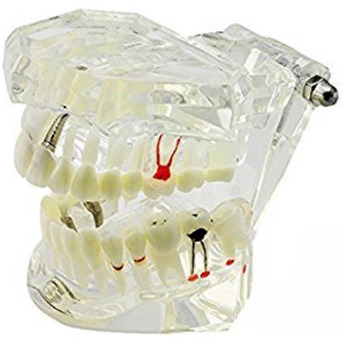 Dental Study Teaching Teeth Model Adult Typodont Model Removable Tooth