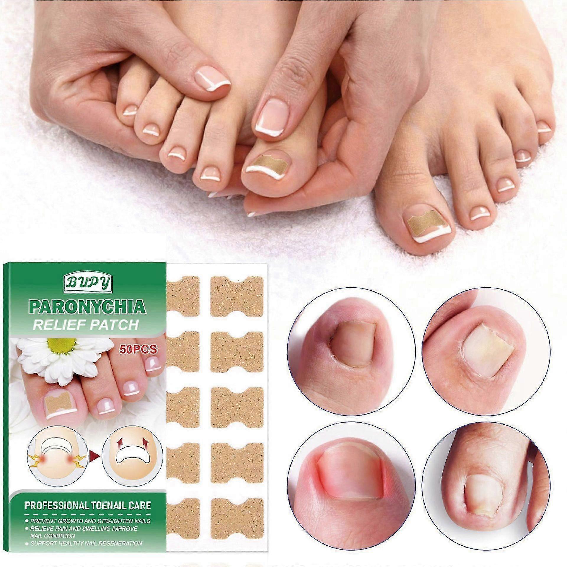 50 Pcs Breathable Toenail Corrector Patch Easy Patches for Toe Nails Pedicure for Ingrown Toenail Corrector Strips, Alleviate Ingrown Toenail Pain, In