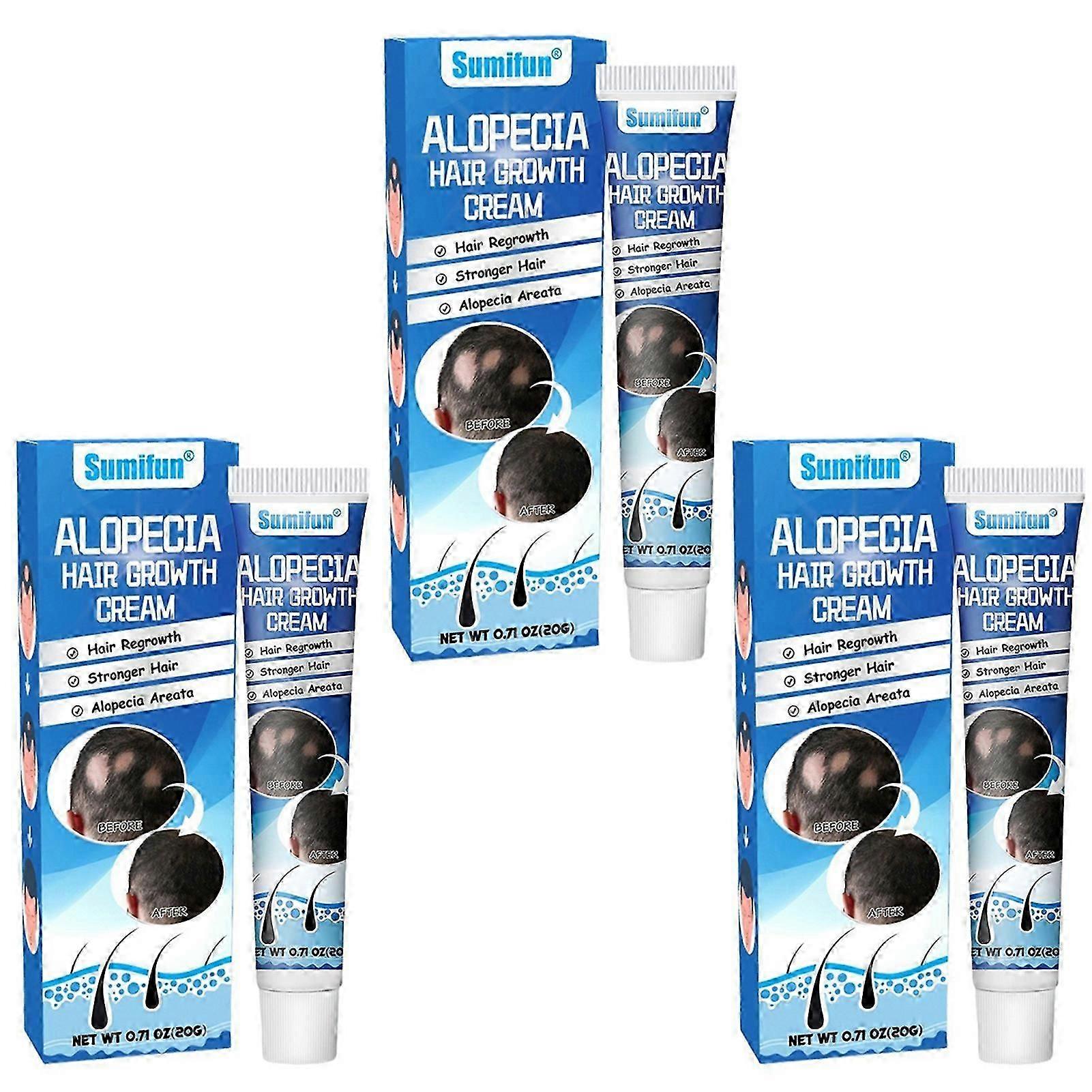 脱毛症育毛クリームは抜け毛を軽減し、すべての髪質の再生クリームを促進します