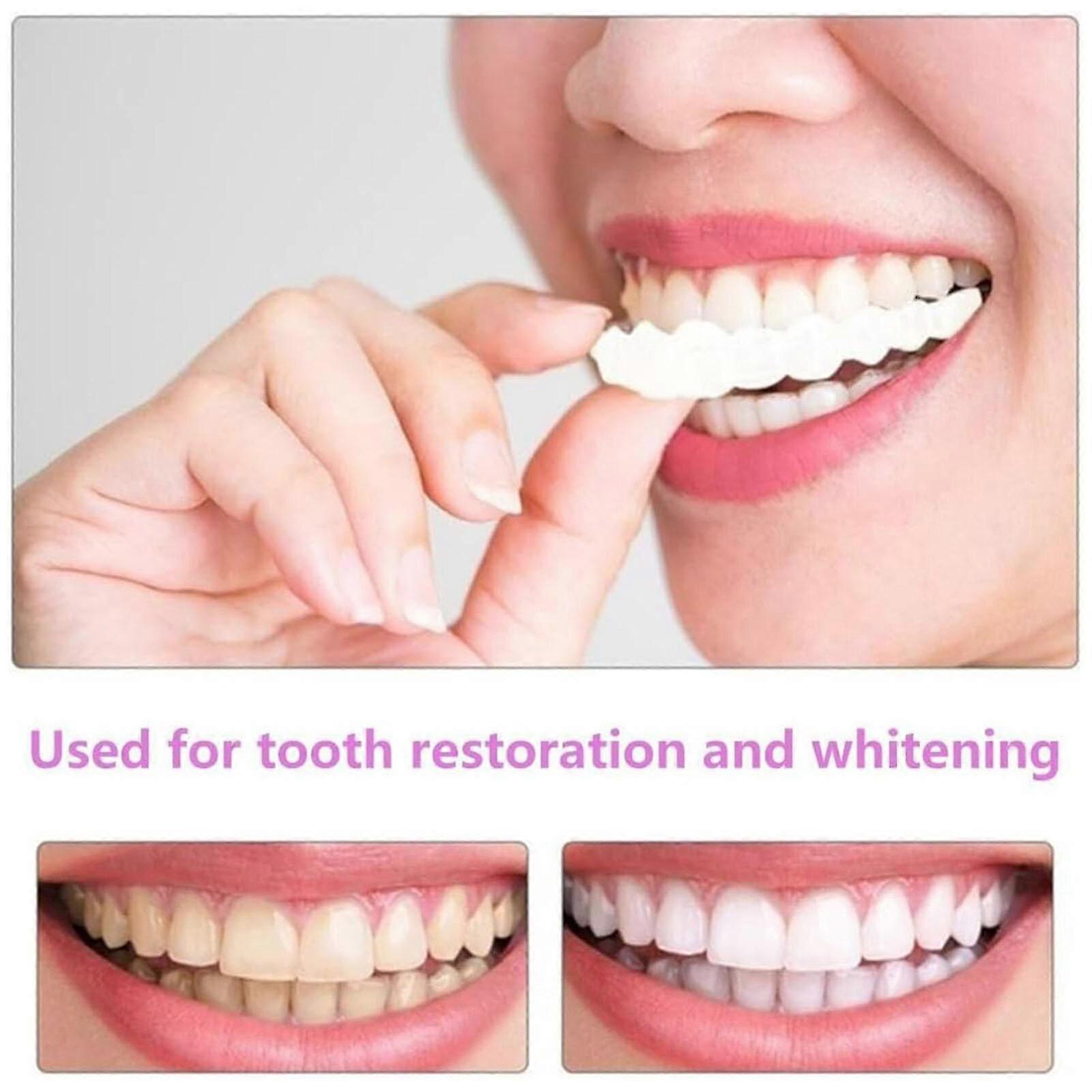 Snap On UpperBottom Teeth Set False Teeth Denture Veneers Dental Tooth Cover