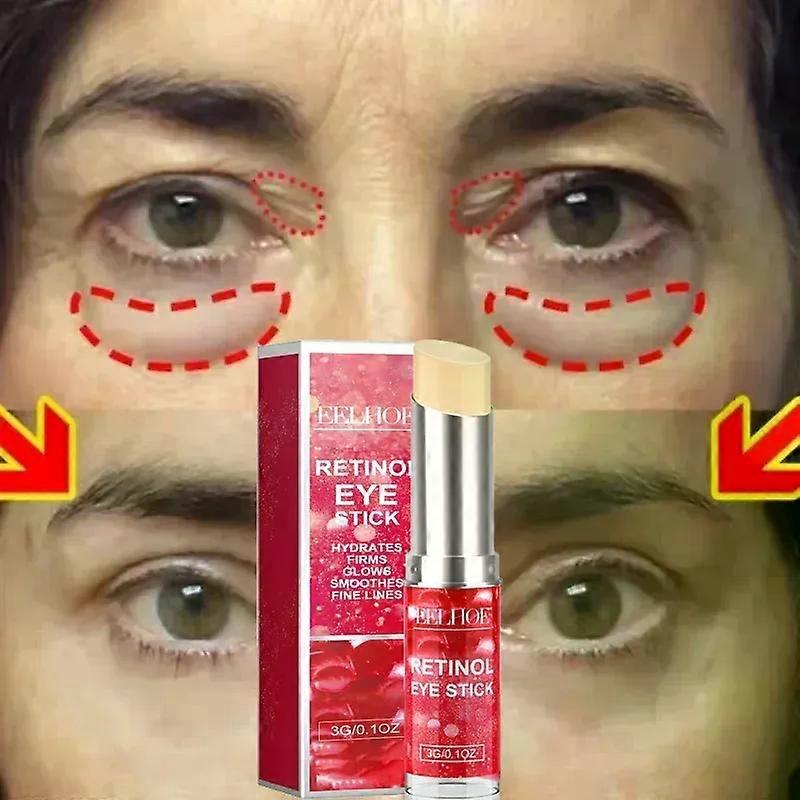 Gaibosiインスタントアイバッグ除去クリームレチノールアンチリンクルフェード小じわしっかりした肌アンチダークサークルアイコントゥアマッサージブライトニングケア