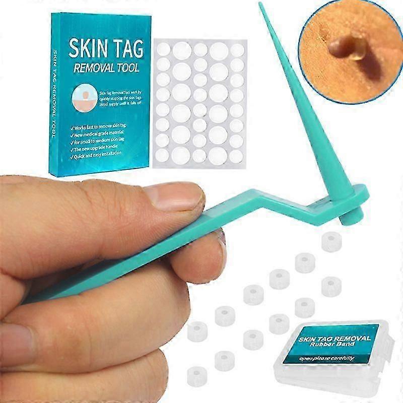 20Pc Micro Band Non Toxic Face Care Mole Wart Tool For Small To Medium Blue Skin Tag