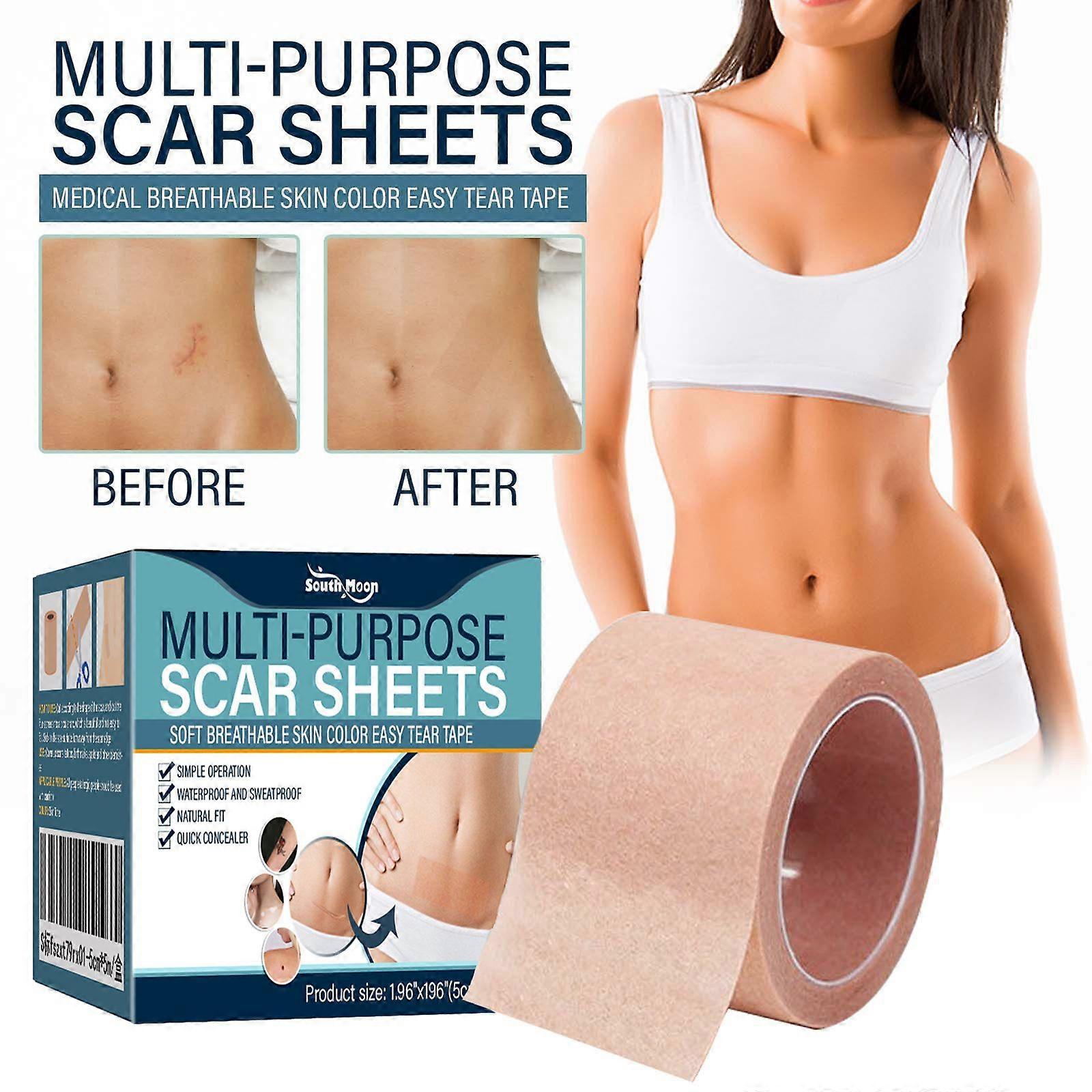 Skin-Colored Concealer Sheets for Covering Birthmarks, Scars, Tattoos, and Spots. Waterproof Color-Colored Concealer Sheets