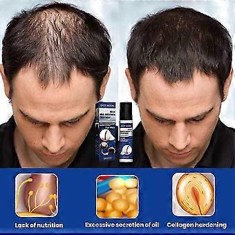 3pcs Foam With Biotin,hair Regrowth Treatment With Added Natural Hair Growths