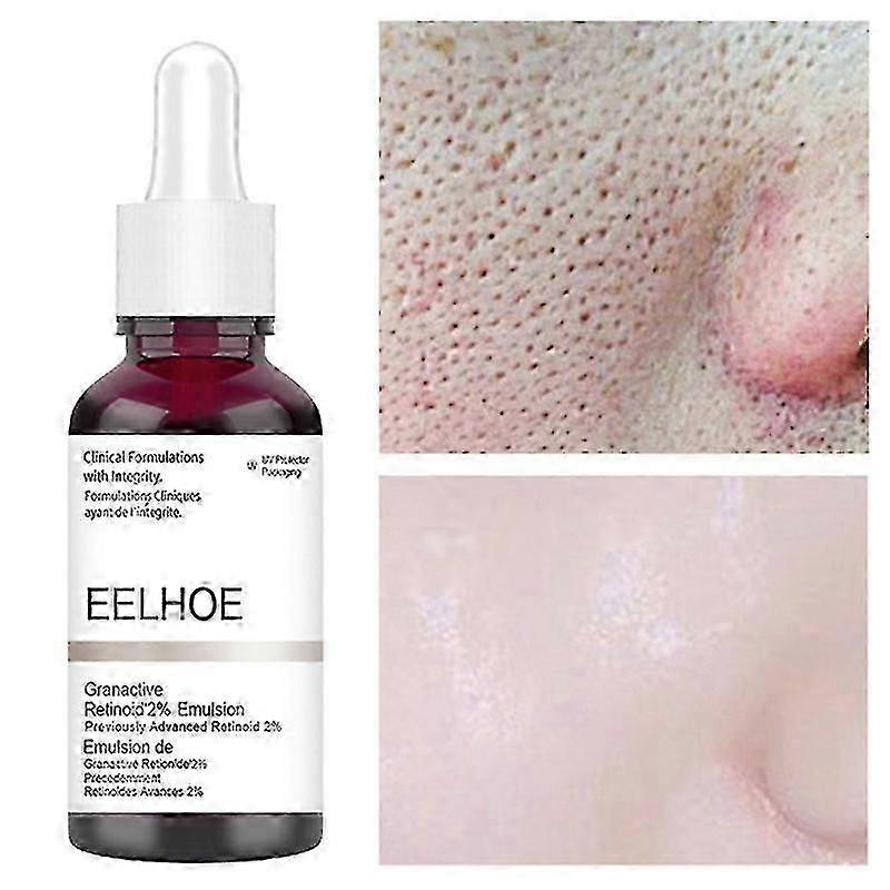 2025 Essence for smooth skin with salicylic acid and pore repair