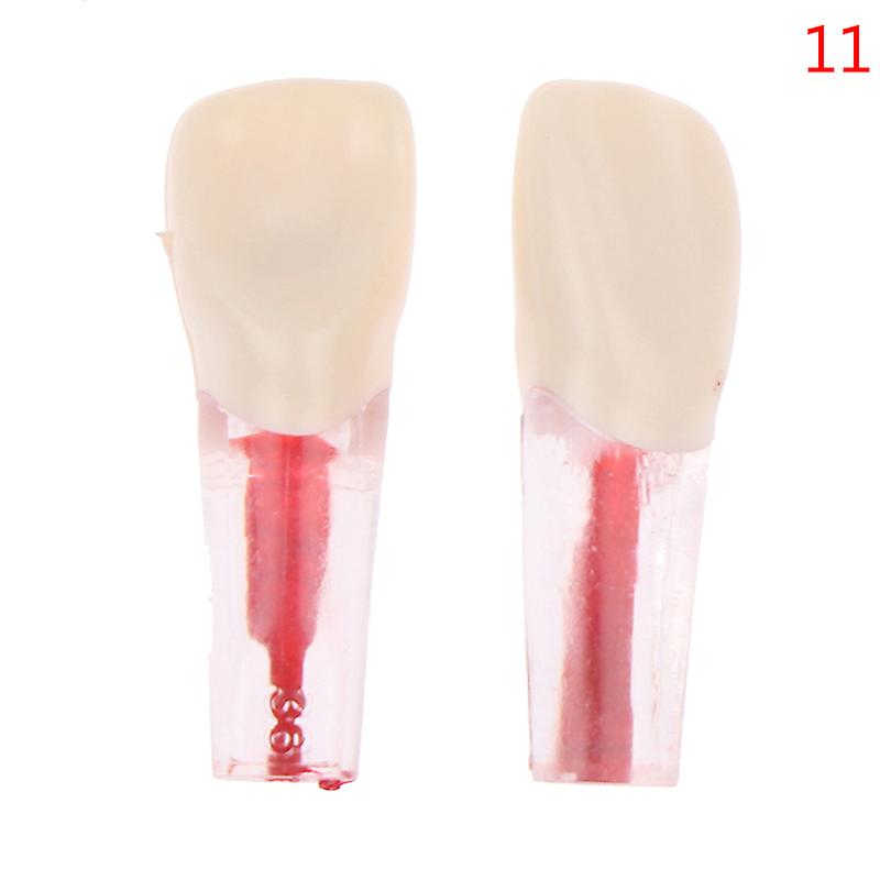 2pcs Resin Dental Endodontic Tooth Model Endo Root Canal Files Pulp Practice